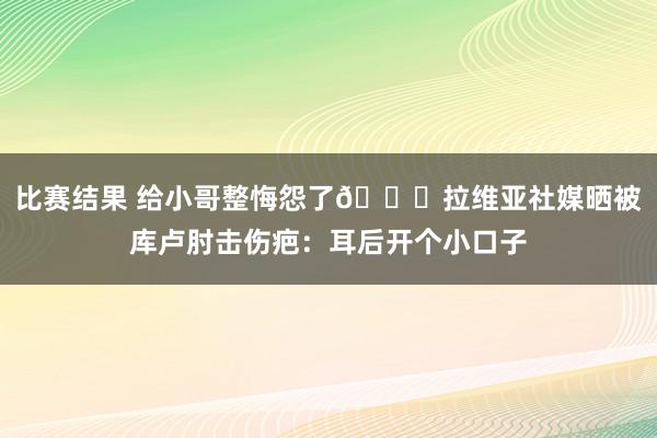 比赛结果 给小哥整悔怨了😅拉维亚社媒晒被库卢肘击伤疤：耳后开个小口子